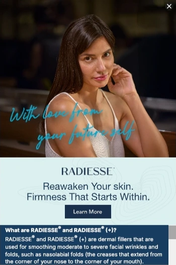 Radiesse — Motion Display — Medical & cosmetic aesthetics